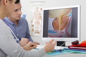 Patient and doctor looking prostate diagram on a computer screen